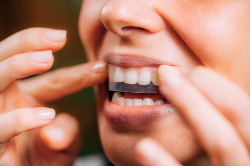 Teeth whitening strips being tried on by a woman